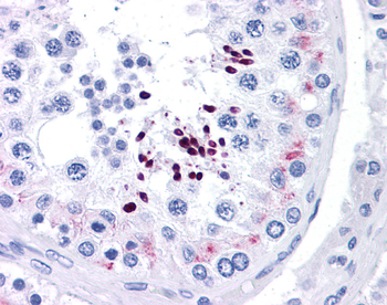 CCND1 Rabbit Polyclonal Antibody