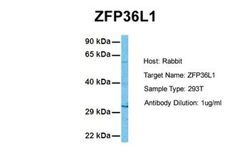 ZFP36L1 Rabbit Polyclonal Antibody