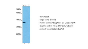 ZFP36L1 Rabbit Polyclonal Antibody