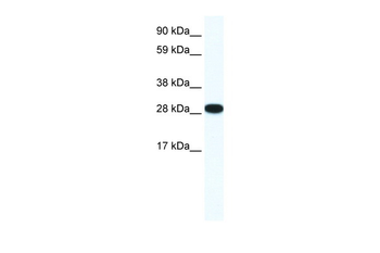 ZFP36L1 Rabbit Polyclonal Antibody