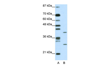 ZFP36L1 Rabbit Polyclonal Antibody
