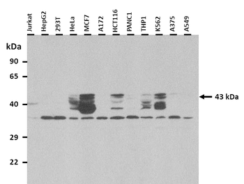 TBX1 Rabbit Polyclonal Antibody