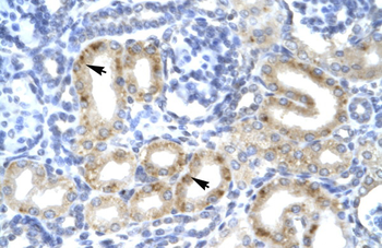 TBX1 Rabbit Polyclonal Antibody