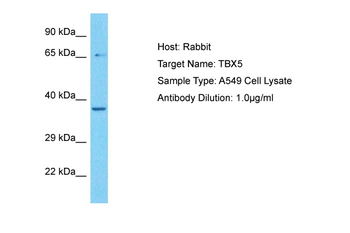 TBX5 Rabbit Polyclonal Antibody