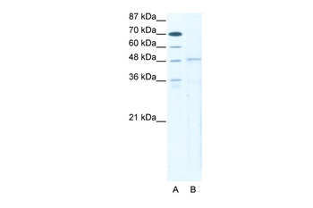 TBX5 Rabbit Polyclonal Antibody