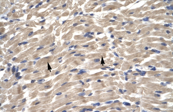 TBX6 Rabbit Polyclonal Antibody