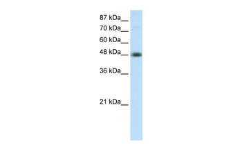 TFAP2B Rabbit Polyclonal Antibody