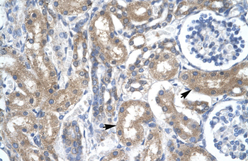 TFDP2 Rabbit Polyclonal Antibody