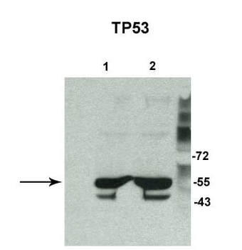 TP53 Rabbit Polyclonal Antibody
