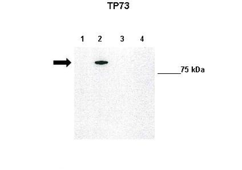 TP73 Rabbit Polyclonal Antibody