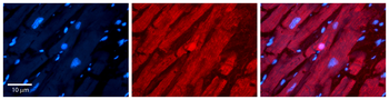 TSG101 Rabbit Polyclonal Antibody