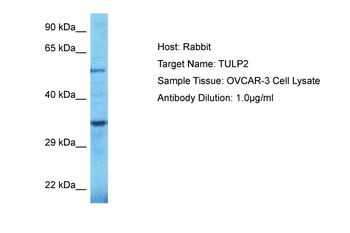 TULP2 Rabbit Polyclonal Antibody