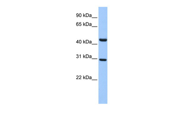 TULP3 Rabbit Polyclonal Antibody
