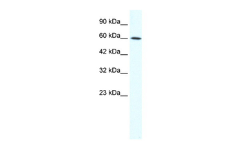 IRX1 Rabbit Polyclonal Antibody