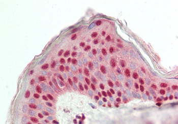 GRHL2 Rabbit Polyclonal Antibody