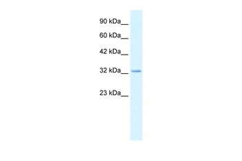 CLDN10 Rabbit Polyclonal Antibody