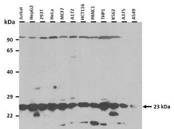 CLDN1 Rabbit Polyclonal Antibody