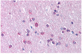 CLDN11 Rabbit Polyclonal Antibody