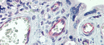 CLDN23 Rabbit Polyclonal Antibody