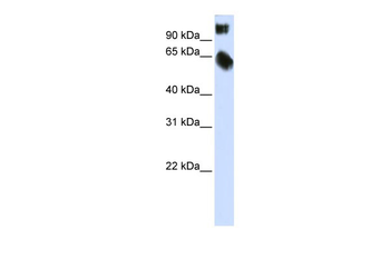 TSC22D2 Rabbit Polyclonal Antibody
