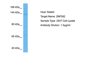ZNF592 Rabbit Polyclonal Antibody