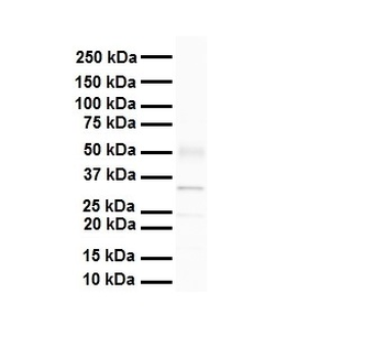 PARP16 Rabbit Polyclonal Antibody