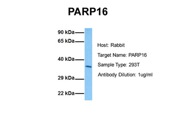 PARP16 Rabbit Polyclonal Antibody