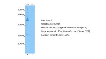 PARP16 Rabbit Polyclonal Antibody