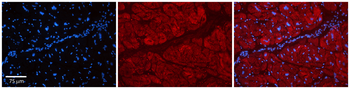 PARP16 Rabbit Polyclonal Antibody