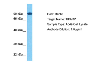TIPARP Rabbit Polyclonal Antibody