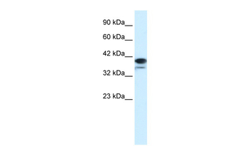 PARP6 Rabbit Polyclonal Antibody