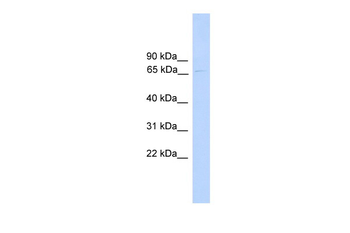 PARP6 Rabbit Polyclonal Antibody