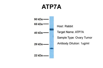 ATP7A Rabbit Polyclonal Antibody