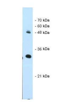 ATP7A Rabbit Polyclonal Antibody