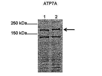 ATP7A Rabbit Polyclonal Antibody