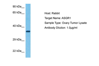 ASGR1 Rabbit Polyclonal Antibody