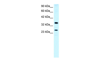 ASGR2 Rabbit Polyclonal Antibody