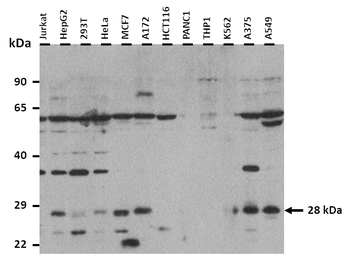 CTRB1 Rabbit Polyclonal Antibody