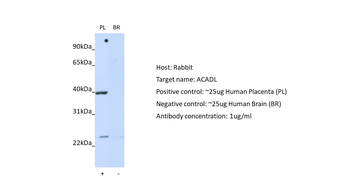 ACADL Rabbit Polyclonal Antibody