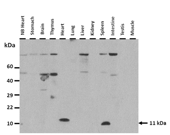 S100b Rabbit Polyclonal Antibody