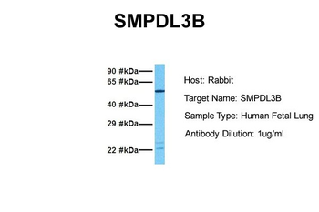 SMPDL3B Rabbit Polyclonal Antibody