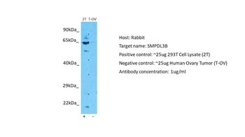 SMPDL3B Rabbit Polyclonal Antibody