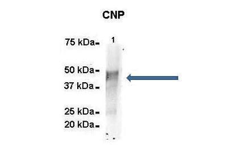 CNP Rabbit Polyclonal Antibody
