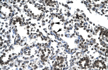 PTHLH Rabbit Polyclonal Antibody