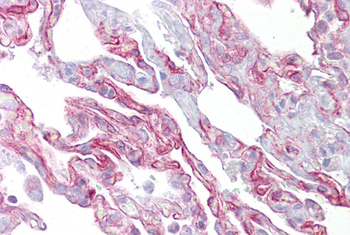 Pthlh Rabbit Polyclonal Antibody