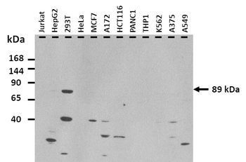KCNB1 Rabbit Polyclonal Antibody