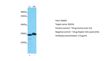 RGS16 Rabbit Polyclonal Antibody