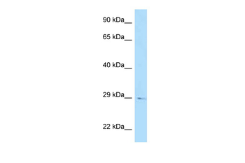 RGS20 Rabbit Polyclonal Antibody