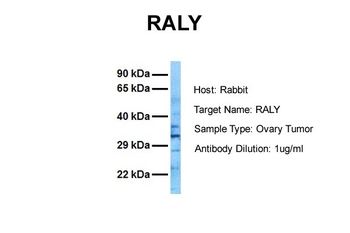 RALY Rabbit Polyclonal Antibody