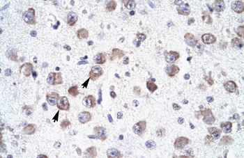 RALY Rabbit Polyclonal Antibody